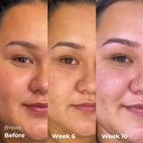 Glow & Grow Bundle: Nourishing Brow Gel & 2-in-1 Lash & Brow Growth Serum